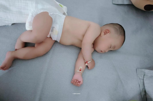 渠县六个月宝宝眼睛散光
